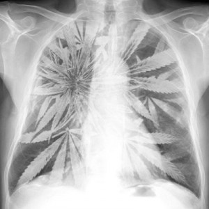 marijuana-lung-cancer-300x300